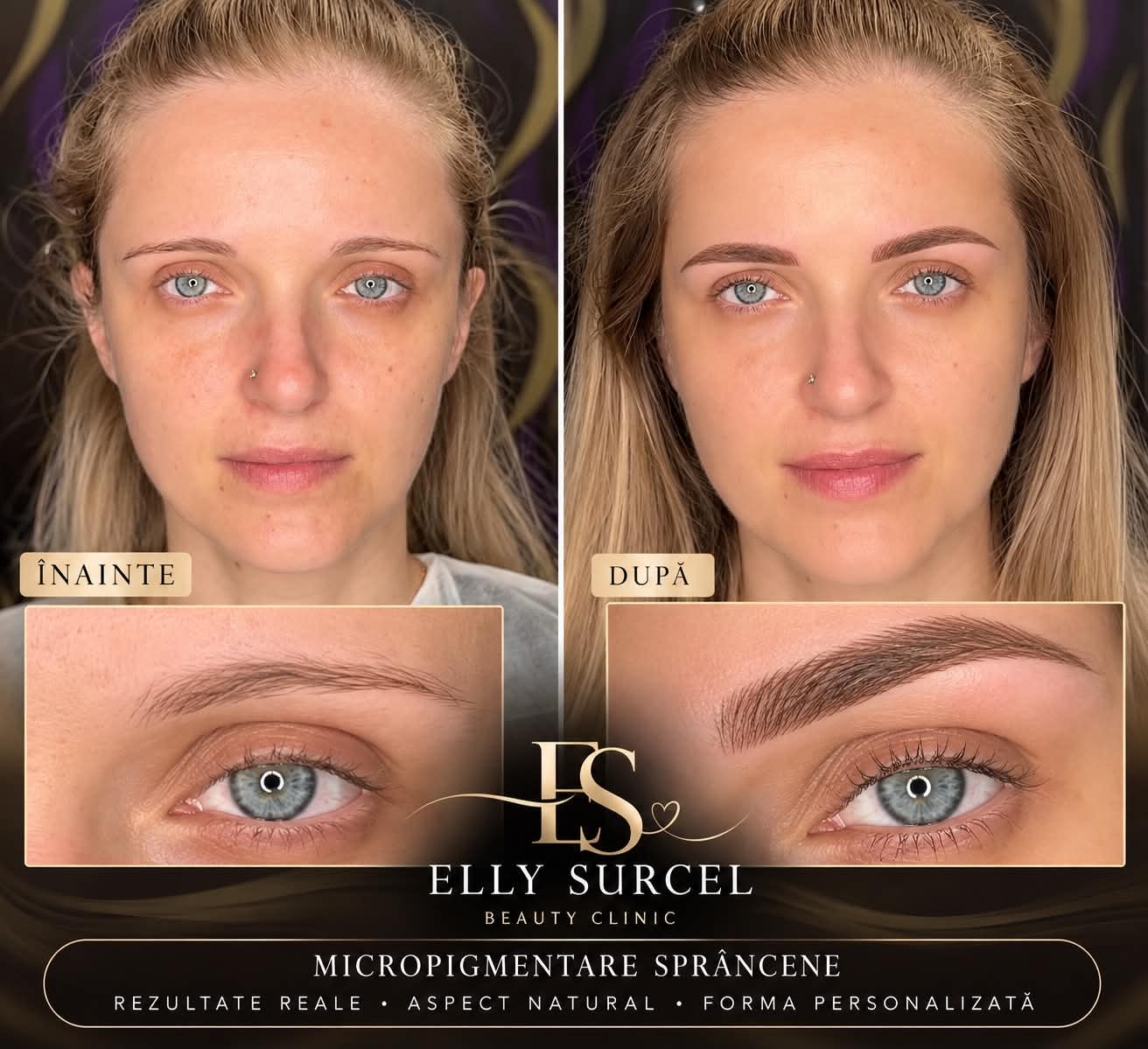 Elly Surcel