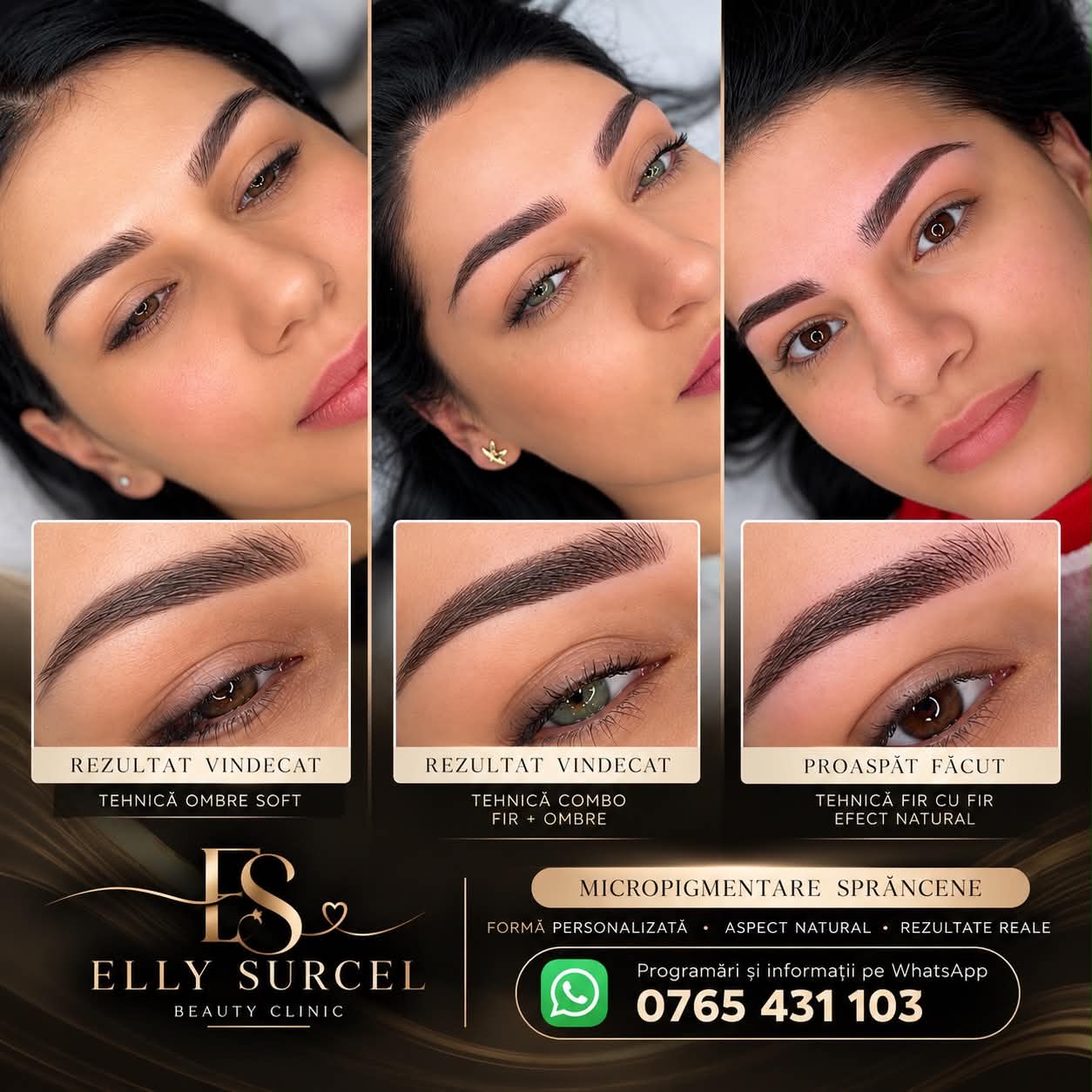 Elly Surcel